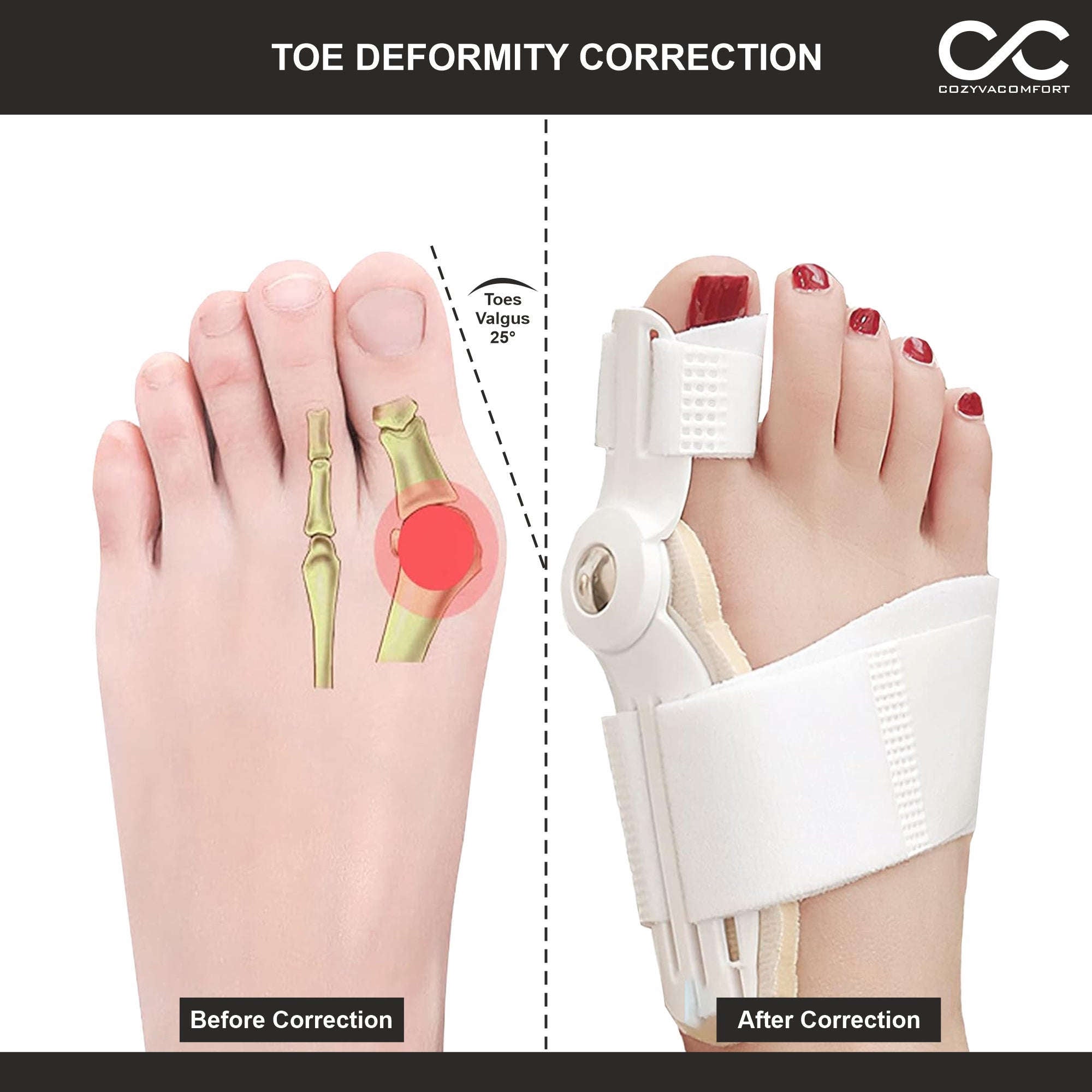 Bunion corrector sleeve and Foot guard Cozyva Comfort