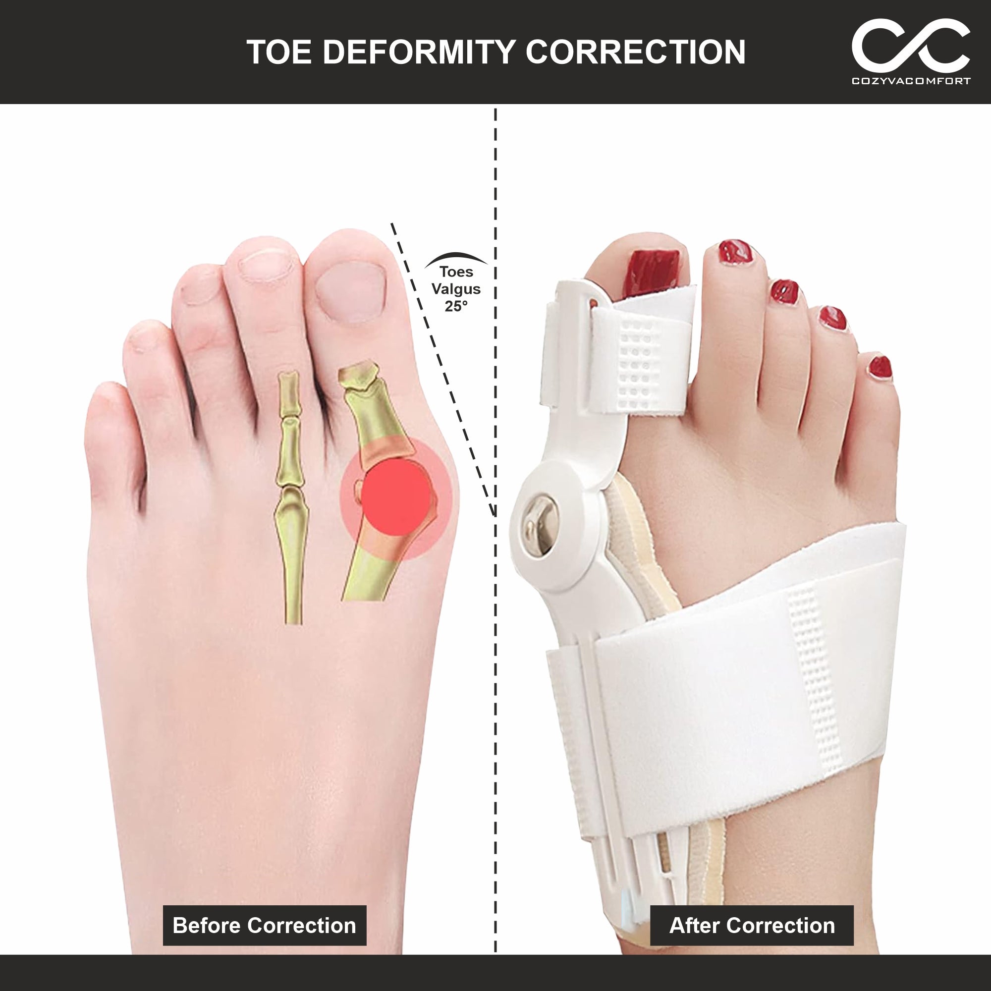 Thumb Support Strap – Adjustable Finger Brace